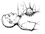 herzmassage
